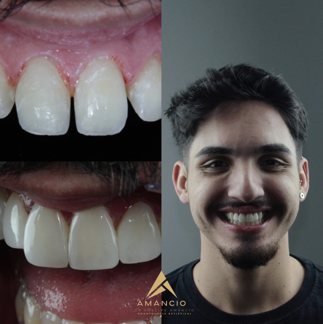 DR.PHELIPE AMÂNCIO ODONTOLOGIA EST(ÉTICA) (2)